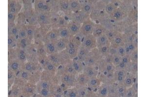 Immunohistochemistry (IHC) image for anti-Bactericidal/Permeability Increasing Protein (BPI) (AA 320-457) antibody (ABIN7433300)