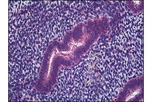 Human Uterus, Endometrium: Formalin-Fixed, Paraffin-Embedded (FFPE) (IFITM1 antibody)
