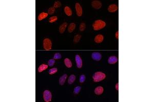 Immunofluorescence analysis of U-2 OS cells using SUN2 antibody (ABIN7270136) at dilution of 1:100. (SUN2 antibody)
