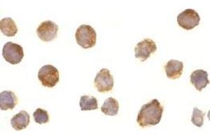 Immunocytochemistry of BTK in Daudi cells with AP30170PU-N BTK antibody at 10 μg/ml. (BTK antibody  (N-Term))