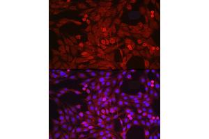 Immunofluorescence analysis of PC-12 cells using  Rabbit pAb (ABIN3015338, ABIN3015339, ABIN5663782 and ABIN6213995) at dilution of 1:50 (40x lens). (ADAM17 antibody  (C-Term))