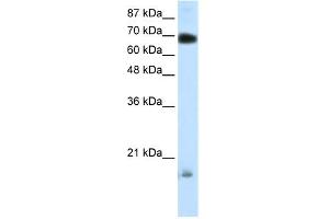 WB Suggested Anti-TRIM32 Antibody Titration: 0.