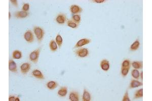 Immunocytochemistry analysis of ABIN7139181 diluted at 1:20 and staining in Hela cells (treated with 30mM sodium butyrate for 4h) performed on a Leica BondTM system. (H2AFZ antibody  (acLys4))