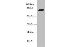Western blot All lanes: SORBS3 antibody at 8 μg/mL + HepG2 whole cell lysate Secondary Goat polyclonal to rabbit IgG at 1/10000 dilution Predicted band size: 76, 37 kDa Observed band size: 76 kDa (Vinexin antibody  (AA 1-329))