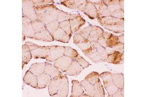 Immunohistochemistry (IHC) image for anti-Desmin (DES) (AA 1-304) antibody (ABIN3043265)