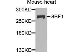 Western blot analysis of extracts of mouse heart, using GBF1 antibody. (GBF1 antibody)
