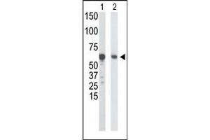 Western Blotting (WB) image for anti-Glucokinase (Hexokinase 4) (GCK) (N-Term) antibody (ABIN5552277) (GCK antibody  (N-Term))
