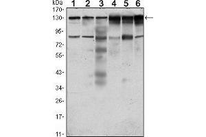Western blot analysis using PTK7 mouse mAb against Hela (1), A431 (2), HCT116 (3), Caco2 (4), HepG2 (5) and MCF-7 (6) cell lysate. (PTK7 antibody)