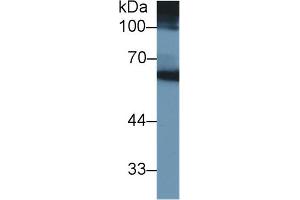 Detection of MMP3 in Human Blood Cells lysate using Monoclonal Antibody to Matrix Metalloproteinase 3 (MMP3) (MMP3 antibody  (AA 363-477))