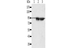 Gel: 10 % SDS-PAGE, Lysate: 60 μg, Lane 1-3: A549 cells, lncap cells, human seminoma tissue, Primary antibody: ABIN7192627(SPATA20 Antibody) at dilution 1/1000, Secondary antibody: Goat anti rabbit IgG at 1/8000 dilution, Exposure time: 5 minutes (SPATA2 antibody)