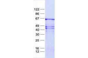 Validation with Western Blot (ZNF8 Protein (His tag))