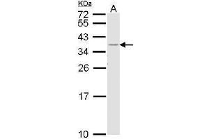 WB Image Sample (30 ug of whole cell lysate) A: H1299 12% SDS PAGE antibody diluted at 1:1000 (HLA-DR antibody  (Center))