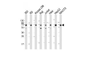 IGF2BP1 antibody  (C-Term)