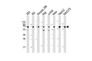 All lanes : Anti-IGF2BP1 Antibody (C-term) at 1:2000 dilution Lane 1: 293 whole cell lysate Lane 2: RD whole cell lysate Lane 3: Karpas 299 whole cell lysate Lane 4: Raji whole cell lysate Lane 5: Jurkat whole cell lysate Lane 6: Hela whole cell lysate Lane 7: HepG2 whole cell lysate Lane 8: NIH/3T3 whole cell lysate Lysates/proteins at 20 μg per lane. (IGF2BP1 antibody  (C-Term))