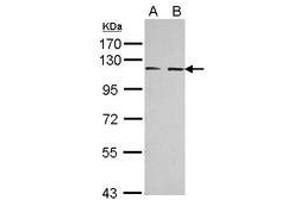 Image no. 2 for anti-EPH Receptor A3 (EPHA3) (AA 38-375) antibody (ABIN1498036) (EPH Receptor A3 antibody  (AA 38-375))