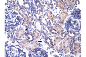 Immunohistochemistry (IHC) image for anti-TNF Receptor-Associated Protein 1 (TRAP1) (N-Term) antibody (ABIN2792093)