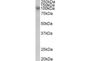 Western Blotting (WB) image for anti-ADAM Metallopeptidase Domain 8 (ADAM8) antibody (ABIN5911617) (ADAM8 antibody)