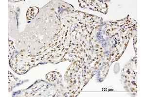 Immunoperoxidase of monoclonal antibody to RUNX2 on formalin-fixed paraffin-embedded human placenta. (RUNX2 antibody  (AA 251-350))