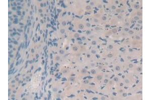 Detection of SYN1 in Mouse Ovary Tissue using Polyclonal Antibody to Synapsin I (SYN1) (SYN1 antibody  (AA 113-420))