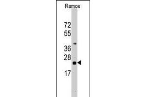 Western blot analysis of CD247 polyclonal antibody  in Ramos cell line lysates (35 ug/lane). (CD247 antibody  (N-Term))
