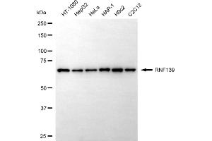 anti-Ring Finger Protein 139 (RNF139) antibody