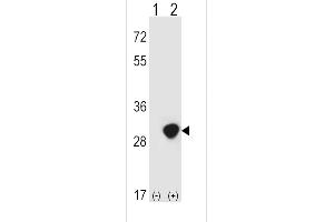 Western blot analysis of TPI1 (arrow) using rabbit polyclonal TPI1 Antibody (N-term) (ABIN389457 and ABIN2839524).