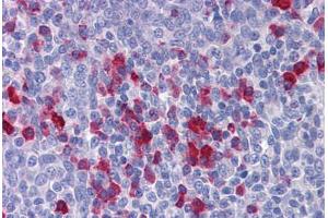 Human Tonsil: Formalin-Fixed, Paraffin-Embedded (FFPE) (APPL1 antibody  (AA 467-516))