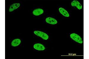 Immunofluorescence of monoclonal antibody to MEF2A on HeLa cell. (MEF2A antibody  (AA 71-170))