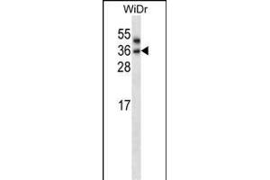 PNPLA4 Antibody (C-term) (ABIN657892 and ABIN2846844) western blot analysis in WiDr cell line lysates (35 μg/lane). (PNPLA4 antibody  (C-Term))