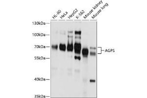Western blot analysis of extracts of various cell lines, using AGPS antibody (ABIN6129641, ABIN6136644, ABIN6136645 and ABIN6214756) at 1:1000 dilution. (AGPS antibody  (AA 379-658))