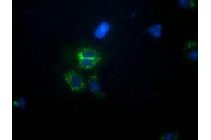 Anti-CALCOCO2 mouse monoclonal antibody (ABIN2453920) immunofluorescent staining of COS7 cells transiently transfected by pCMV6-ENTRY CALCOCO2 (RC203843). (CALCOCO2 antibody)