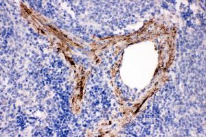 Anti-ADAM19 antibody, IHC(P) IHC(P): Rat Spleen Tissue