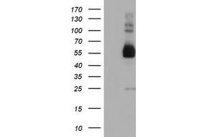 HEK293T cells were transfected with the pCMV6-ENTRY control (Left lane) or pCMV6-ENTRY TULP3 (Right lane) cDNA for 48 hrs and lysed. (TULP3 antibody)