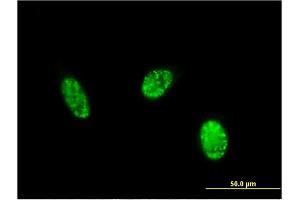 Immunofluorescence of monoclonal antibody to EXOSC1 on HeLa cell. (EXOSC1 antibody  (AA 1-195))