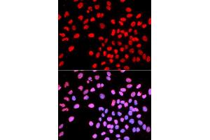 Immunofluorescence analysis of U2OS cells using IKZF1 antibody (ABIN5970949).