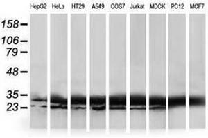 Image no. 3 for anti-Haloacid Dehalogenase-Like Hydrolase Domain Containing 1 (HDHD1) antibody (ABIN1498622)