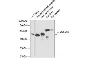 Western blot analysis of extracts of various cell lines using ADRA2B Polyclonal Antibody at dilution of 1:1000. (ADRA2B antibody)