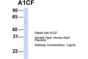 Host:  Rabbit  Target Name:  A1CF  Sample Type:  Human Adult Placenta  Antibody Dilution:  1. (A1CF antibody  (N-Term))
