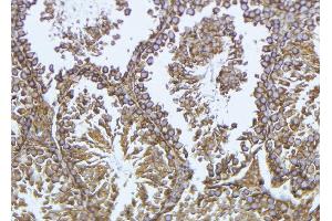 ABIN6276964 at 1/100 staining Mouse testis tissue by IHC-P. (GPX4 antibody  (C-Term))