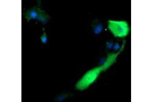 Image no. 2 for anti-Anaphase Promoting Complex Subunit 11 (ANAPC11) antibody (ABIN1496633)