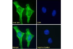 ABIN6391361 Immunofluorescence analysis of paraformaldehyde fixed HeLa cells, permeabilized with 0. (Sonic Hedgehog antibody  (C-Term))