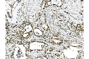 IHC analysis of GRHL2 using anti-GRHL2 antibody (ABIN7599505). (GRHL2 antibody  (AA 1-625))