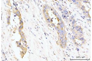 IHC analysis of LARP4B using anti-LARP4B antibody (ABIN7600865). (LARP4B antibody  (AA 241-684))
