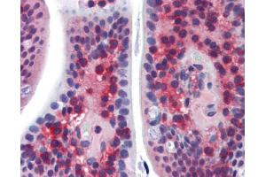 Immunohistochemistry (IHC) image for anti-Synovial Sarcoma, X Breakpoint 2 Interacting Protein (SSX2IP) (Middle Region) antibody (ABIN311620) (SSX2IP antibody  (Middle Region))