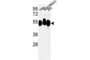 Western Blotting (WB) image for anti-Retinoblastoma Binding Protein 7 (RBBP7) antibody (ABIN3003931) (RBBP7 antibody)