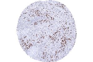 Spleen S100A12 immunostaining is seen in granulocytes of mainly the red pulp. (S100A12 antibody)