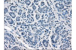 Immunohistochemical staining of paraffin-embedded breast tissue using anti-SLC2A5 mouse monoclonal antibody.