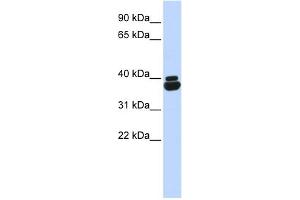 WB Suggested Anti-OTP Antibody Titration:  0. (OTP antibody  (N-Term))