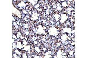 IHC analysis of ACE using anti-ACE antibody (ABIN3043777). (Angiotensin I Converting Enzyme 1 antibody  (AA 651-864))
