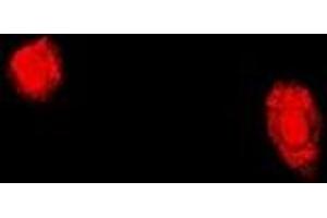 Immunofluorescent analysis of TPP2 staining in U2OS cells. (Tpp2 antibody)